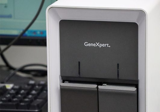 Genexpert4